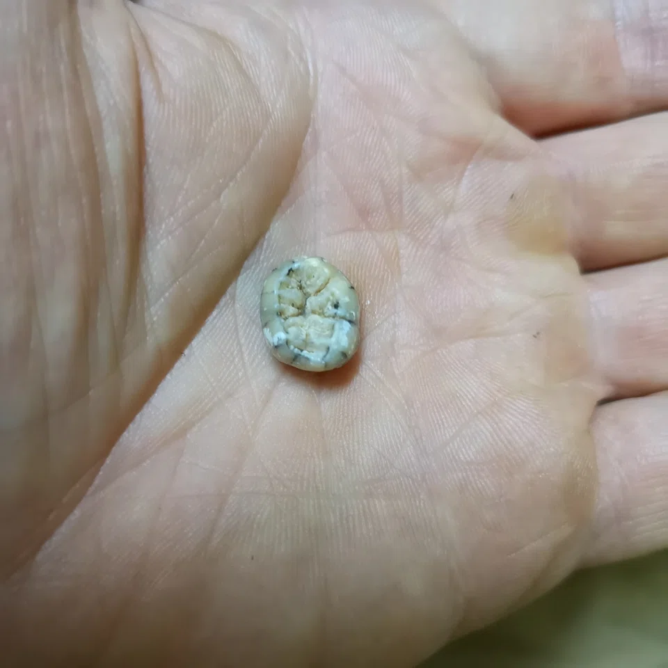 The molar attributed to a young female individual of the extinct human species called the Denisovans, found in cave Tam Ngu Hao 2 in northeastern Laos, is seen in 2018 in the hand of paleoanthropologist Fabrice Demeter in this handout picture.  