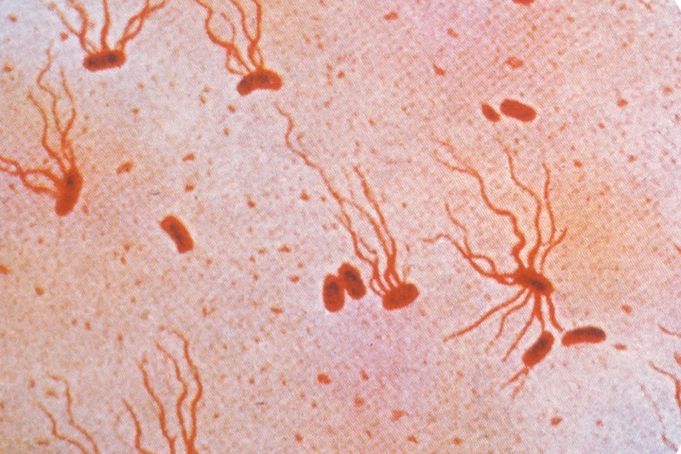 A photomicrograph of S Typhi bacteria. 