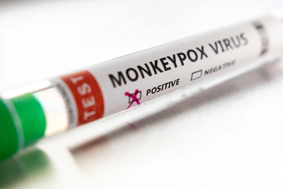 Test tube labelled "Monkeypox virus positive" are seen in this illustration taken May 22, 2022. WHO Director-General Tedros Adhanom Ghebreyesus said the risk of monkeypox becoming established in these non-endemic countries was real, but preventable at this point.