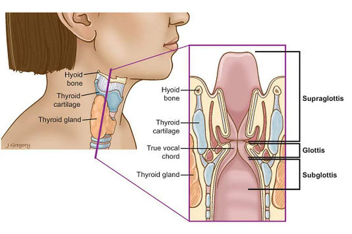 Throat cancer - not just a smoker's disease