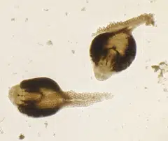 Monogenean worms that were dissected from the gills of a preserved copper rockfish from the Burke Museum specimen collection. Warming temperatures in one part of the world seem to have driven down the parasite population, which play key roles in maintaining healthy ecosystems.
