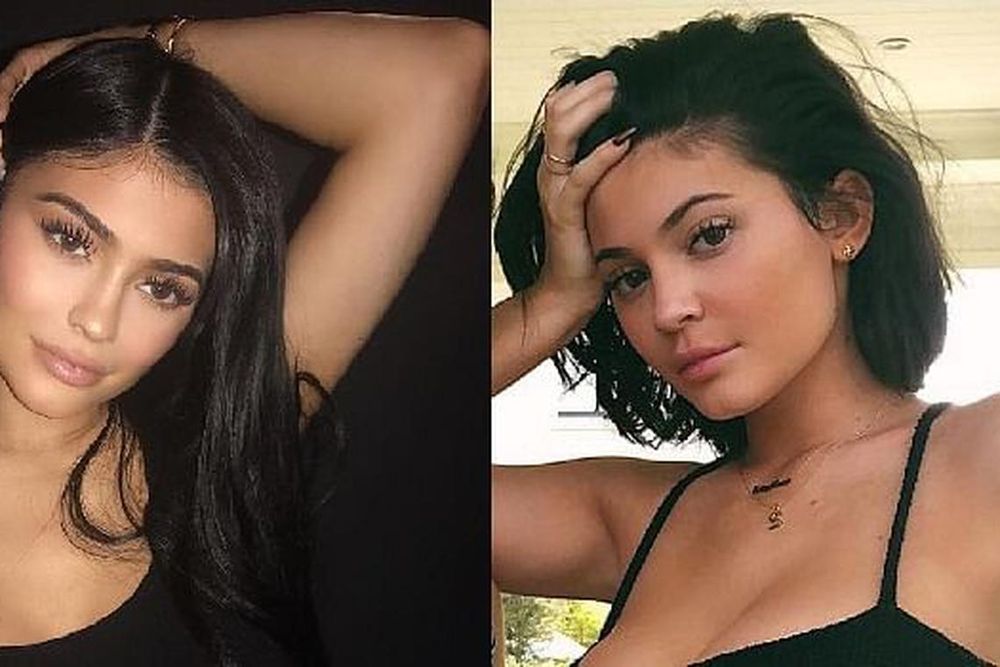 Kylie Jenner reveals on Instagram that she has removed all of her lip fillers