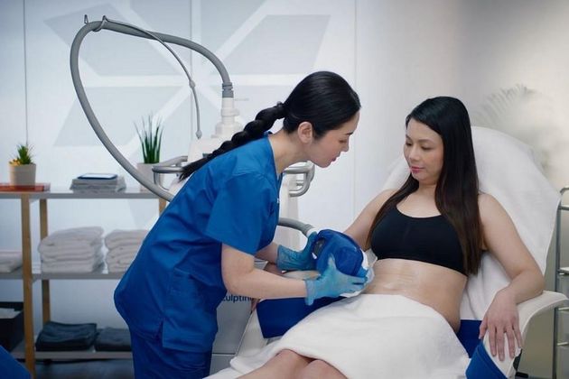 Allergan CoolSculpting - Featured Image
