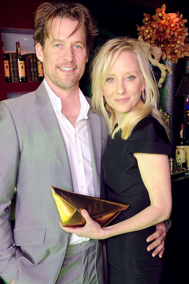 Ellen DeGeneres' ex-girlfriend, actress Anne Heche, announced her separation from husband James Tupper in January. The couple had been together for 10 years before the breakup.

Photo: Getty